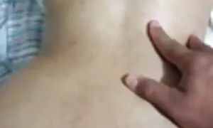 në anal prölapsë tiŋ ...